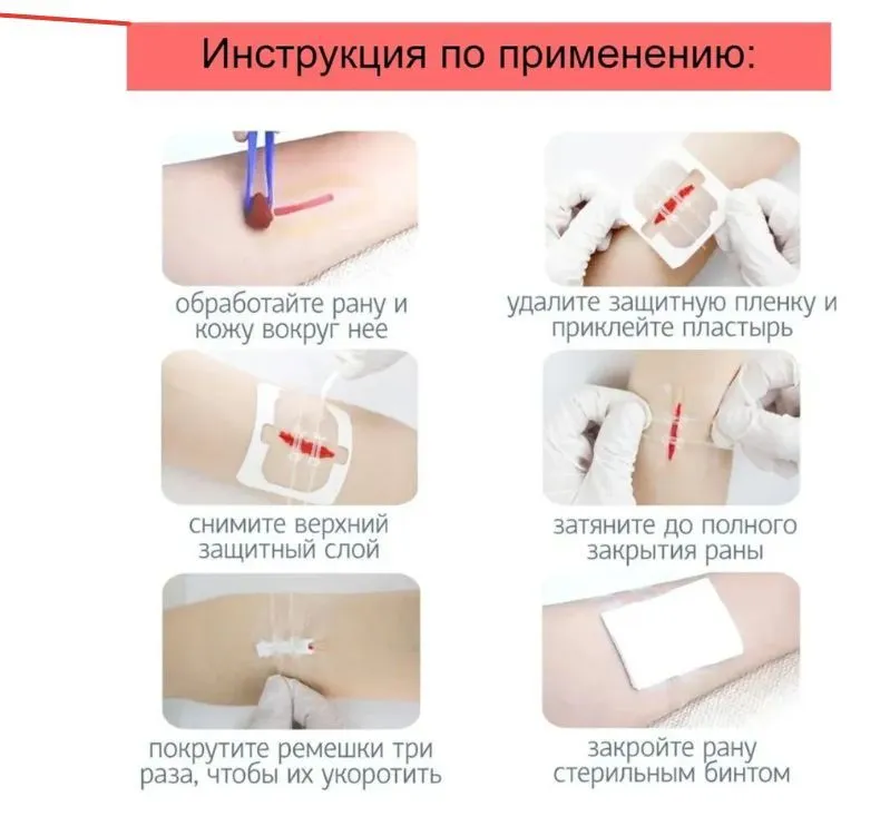 Полоски для стягивания ран "Без шрамов" (1 шт.) с доставкой по России и в Казахстан | BreadyФото 4