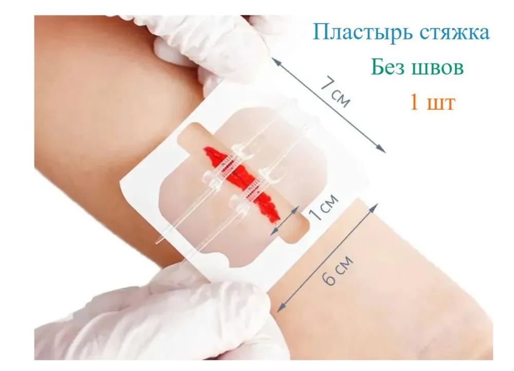 Полоски для стягивания ран "Без шрамов" (упаковка) с доставкой по России и в Казахстан | BreadyФото 7
