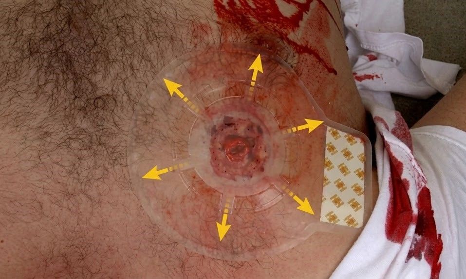 Набор для проникающего ранения грудной клетки Penetrating Chest Injury Kit H&H с доставкой по России | BreadyФото 4