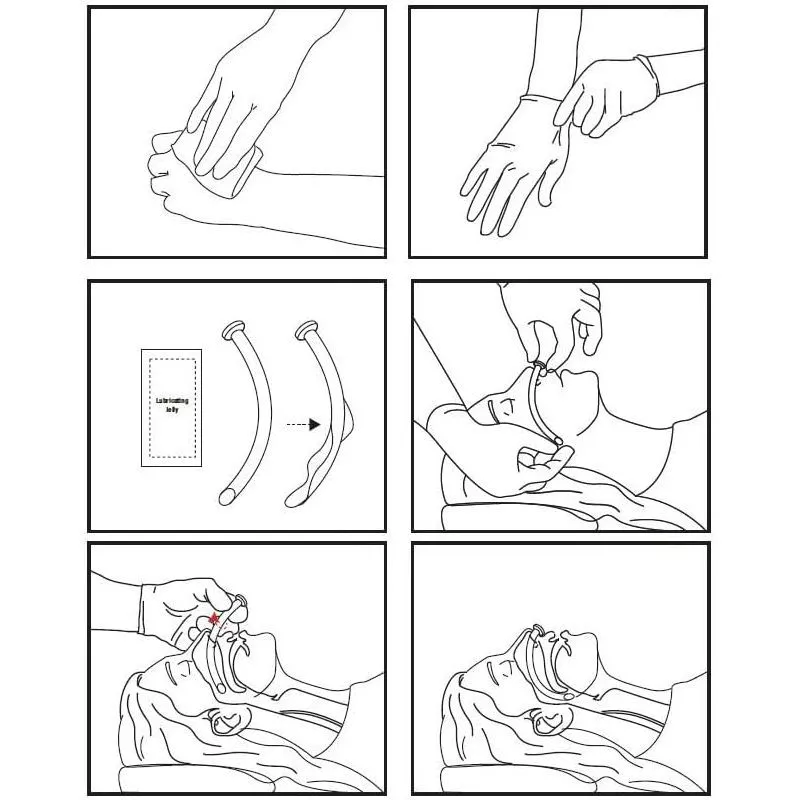 Назофарингеальный воздуховод Rhino Rescue с доставкой по России | BreadyФото 5