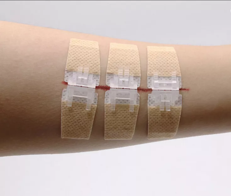 Израильский комплект первой помощи для закрытия ран Laceration Closure Kit с доставкой по России | BreadyФото 8
