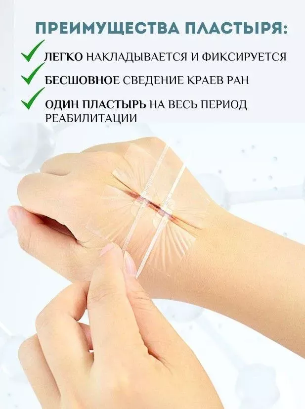 Полоски для стягивания ран "Longmed" (1 шт.) с доставкой по России и в Казахстан | BreadyФото 5