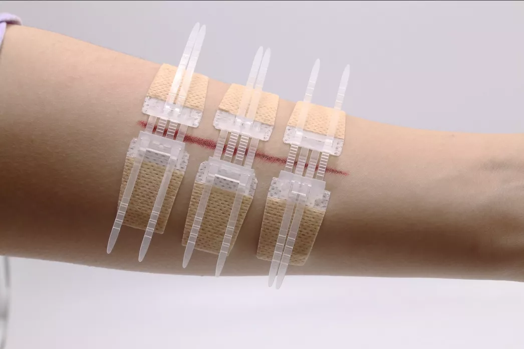 Израильский комплект первой помощи для закрытия ран Laceration Closure Kit с доставкой по России | BreadyФото 6